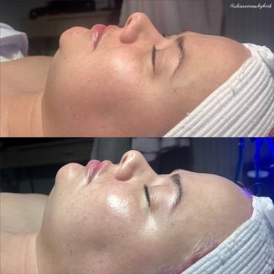 FACIALS